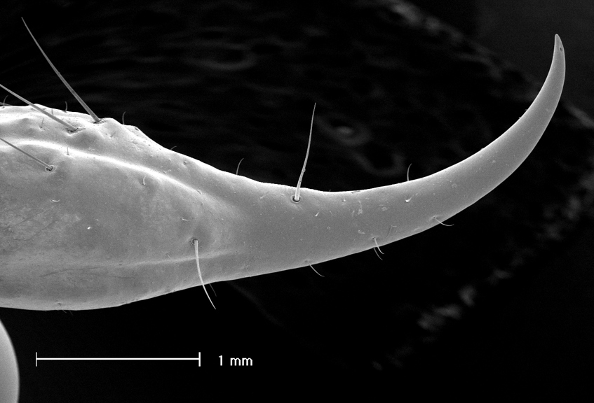 A Scorpion sting (SEM)