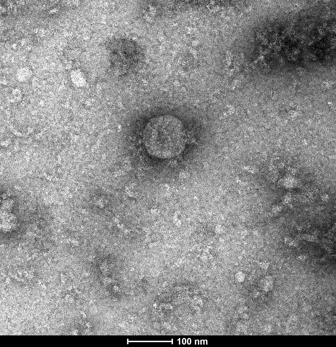 Microscopic photo of a virus