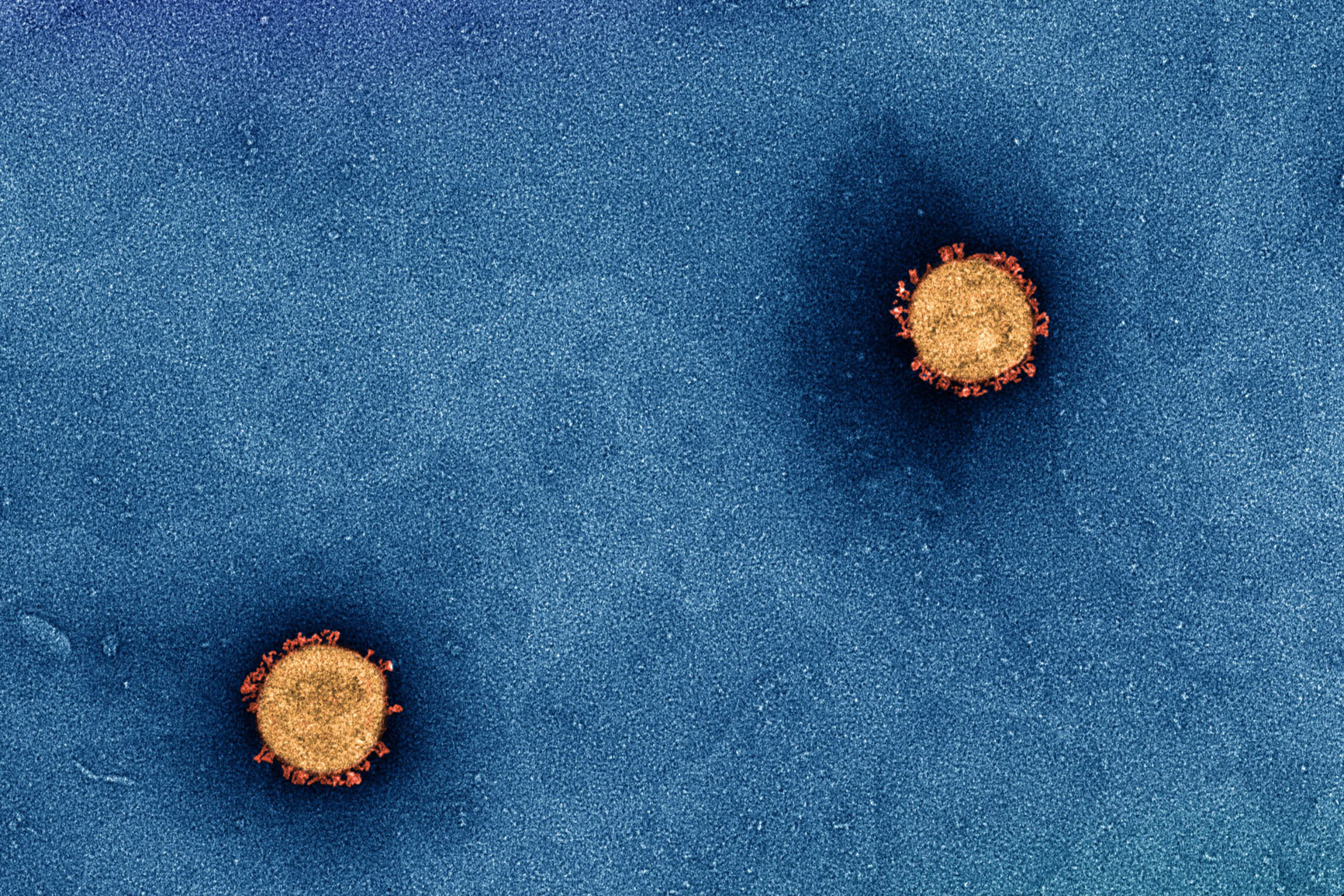 A microscopic picture of a virus surrounded by a spiky coat 